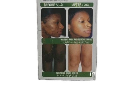 DARMA WHITE CREAM WHITENING ✅️