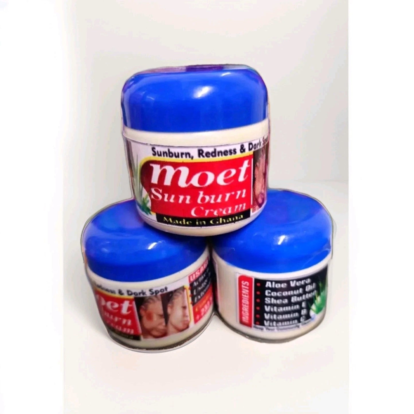 MOET SUNBURN FACE CREAM 60g